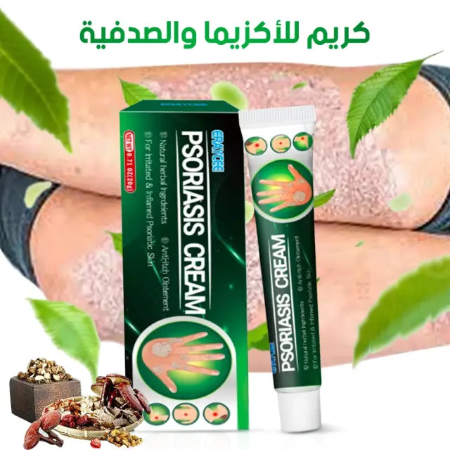 كريم للأكزيما والصدفية