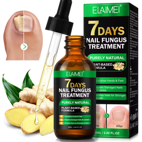 سيروم الزنجبيل لعلاج فطريات الأظافر